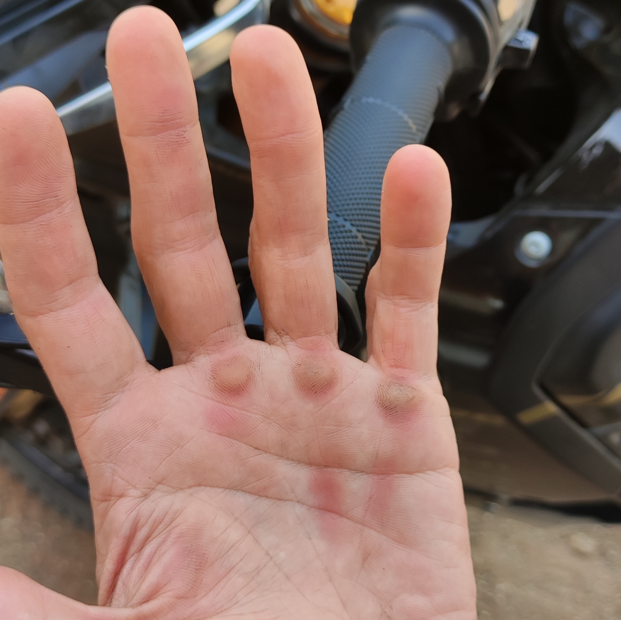 Manos con callos por manilar duro de T7